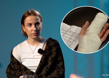 ОМОН оторвал палец беларуске