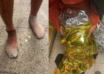 потерял память