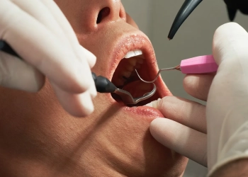 гигиеническая чистка зубов в Польше