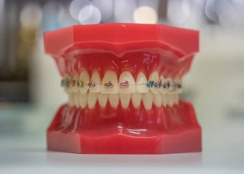 брекеты в Польше