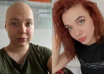 лечение лимфосмы в Польше