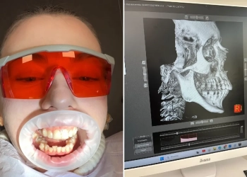 исправление прикуса в Польше